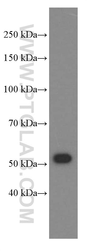 Western Blot (WB) analysis of human skeletal muscle tissue using NAMPT/PBEF Monoclonal antibody (66385-1-Ig)