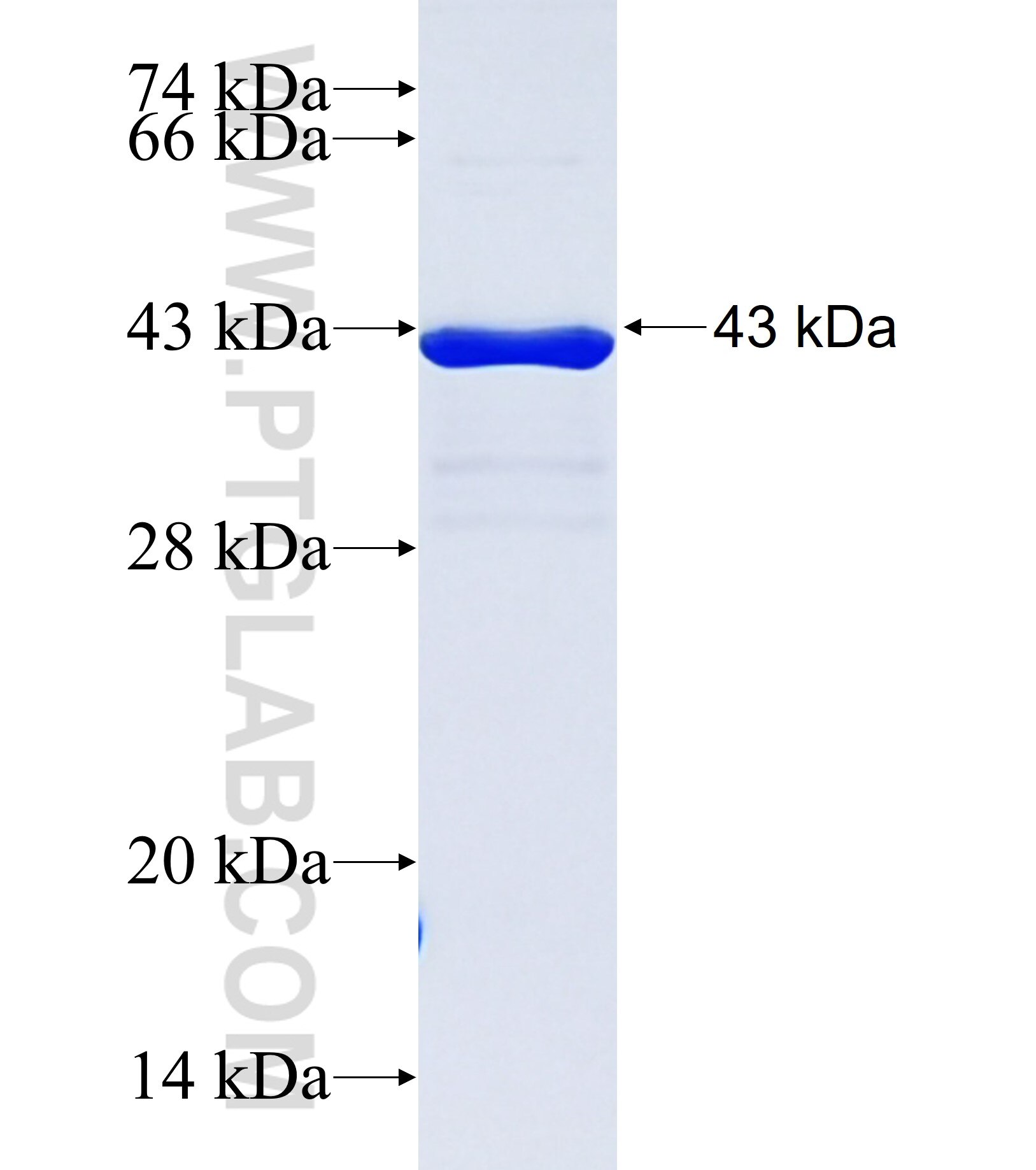 NANOS2 fusion protein Ag37122 SDS-PAGE NANOS2 fusion protein Ag37122 SDS-PAGE