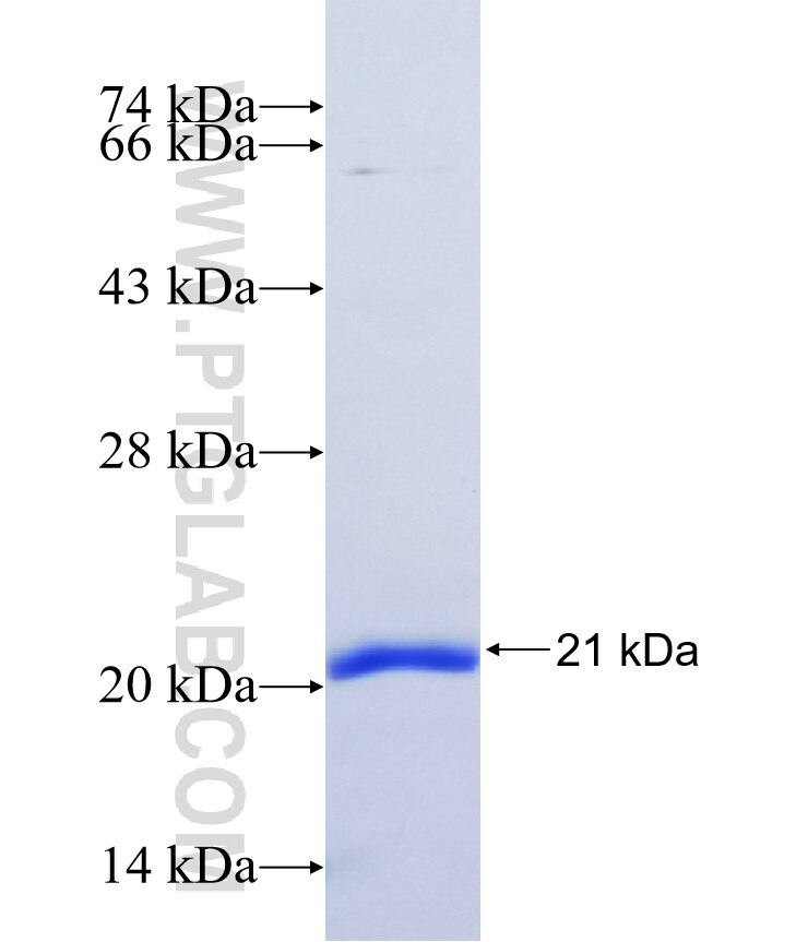 NANOS2 fusion protein Ag37352 SDS-PAGE NANOS2 fusion protein Ag37352 SDS-PAGE
