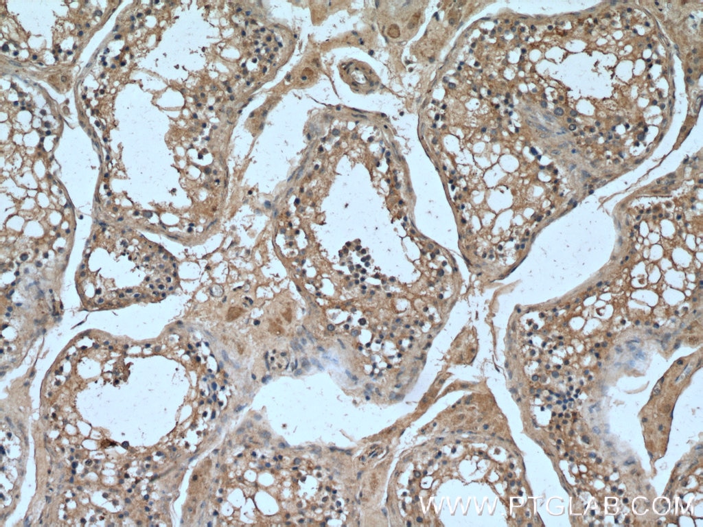 Immunohistochemistry (IHC) staining of human testis tissue using NANOS3 Polyclonal antibody (21679-1-AP)