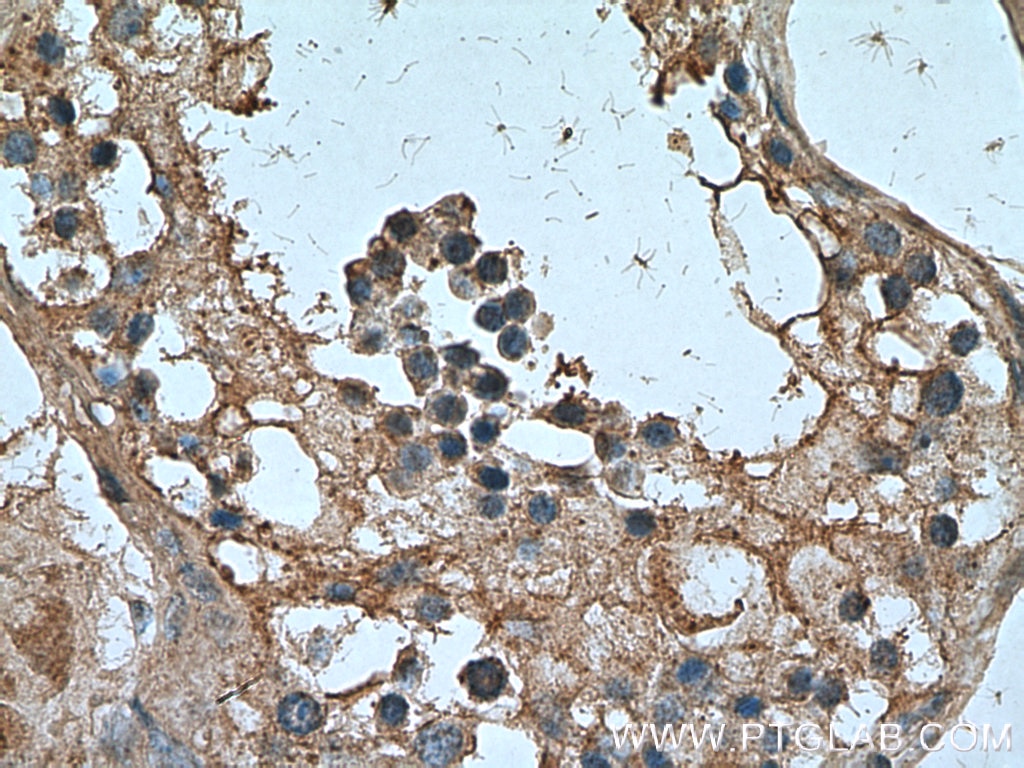 IHC staining of human testis using 21679-1-AP