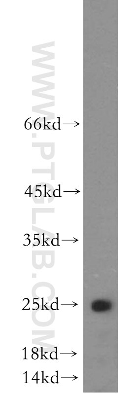 Western Blot (WB) analysis of mouse testis tissue using NANOS3 Polyclonal antibody (21679-1-AP)