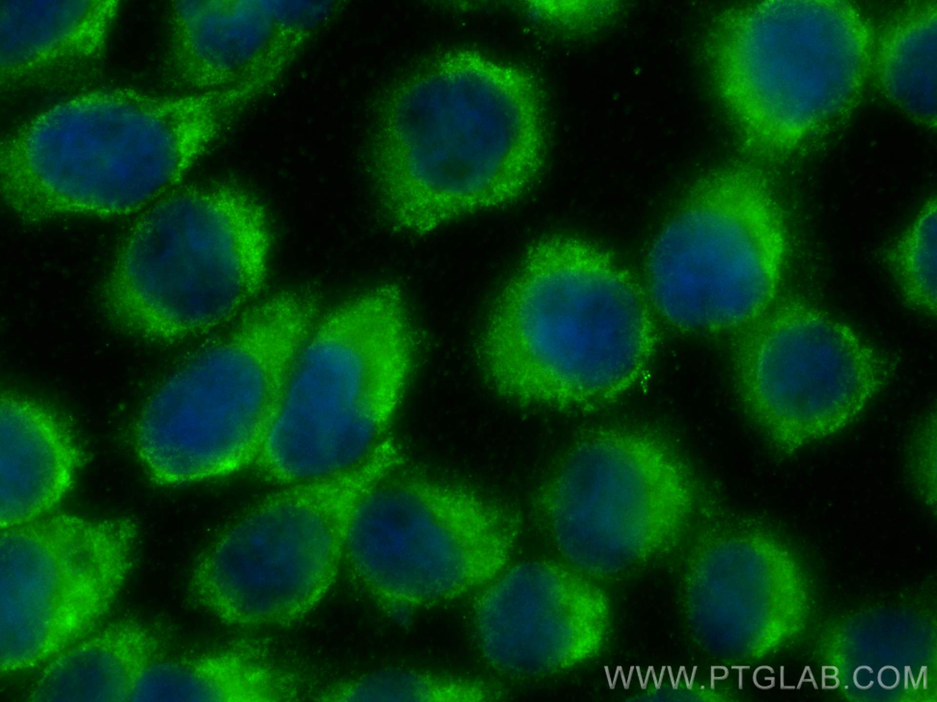 Immunofluorescence (IF) / fluorescent staining of A431 cells using NANP Polyclonal antibody (12519-1-AP)