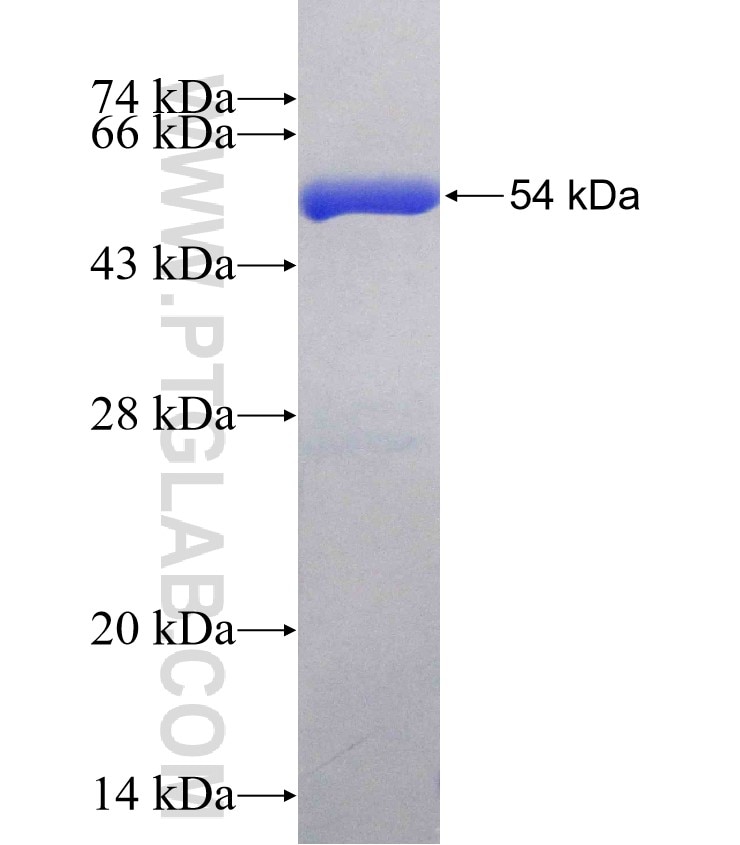 NANP fusion protein Ag3212 SDS-PAGE