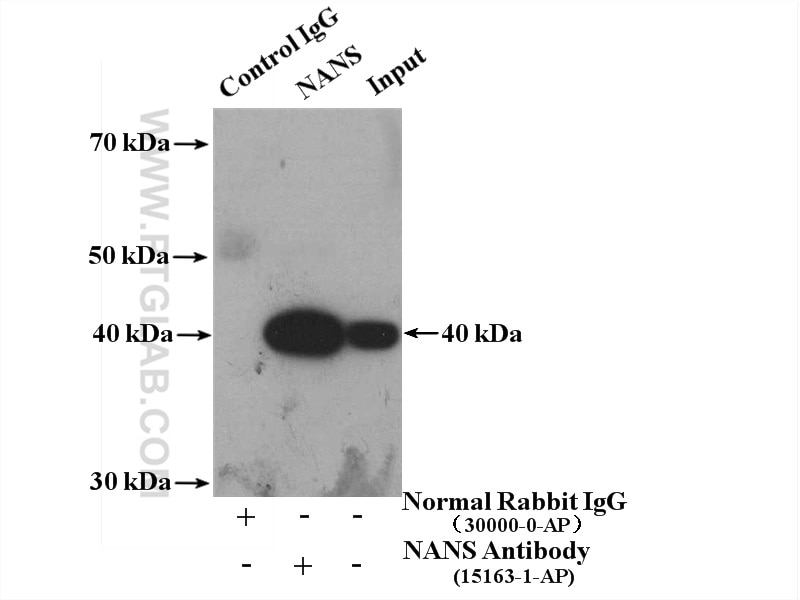 Immunoprecipitation (IP) experiment of HepG2 cells using NANS Polyclonal antibody (15163-1-AP)