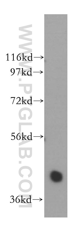 Western Blot (WB) analysis of human brain tissue using NANS Polyclonal antibody (15163-1-AP)