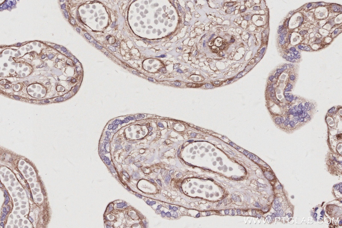 Immunohistochemistry (IHC) staining of human placenta tissue using NAP1;NCKAP1 Recombinant monoclonal antibody (85142-2-RR)