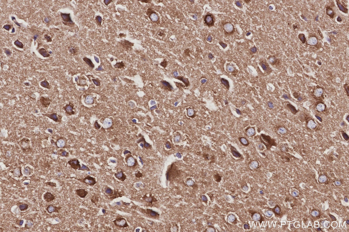 Immunohistochemistry (IHC) staining of mouse brain tissue using NAP1;NCKAP1 Recombinant monoclonal antibody (85142-2-RR)