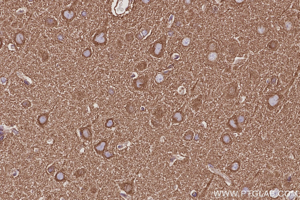 Immunohistochemistry (IHC) staining of rat brain tissue using NAP1;NCKAP1 Recombinant monoclonal antibody (85142-2-RR)
