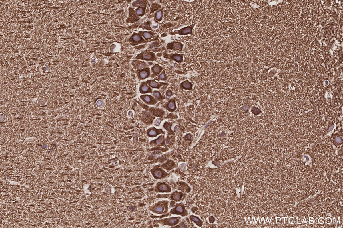 Immunohistochemistry (IHC) staining of rat brain tissue using NAP1;NCKAP1 Recombinant monoclonal antibody (85142-2-RR)