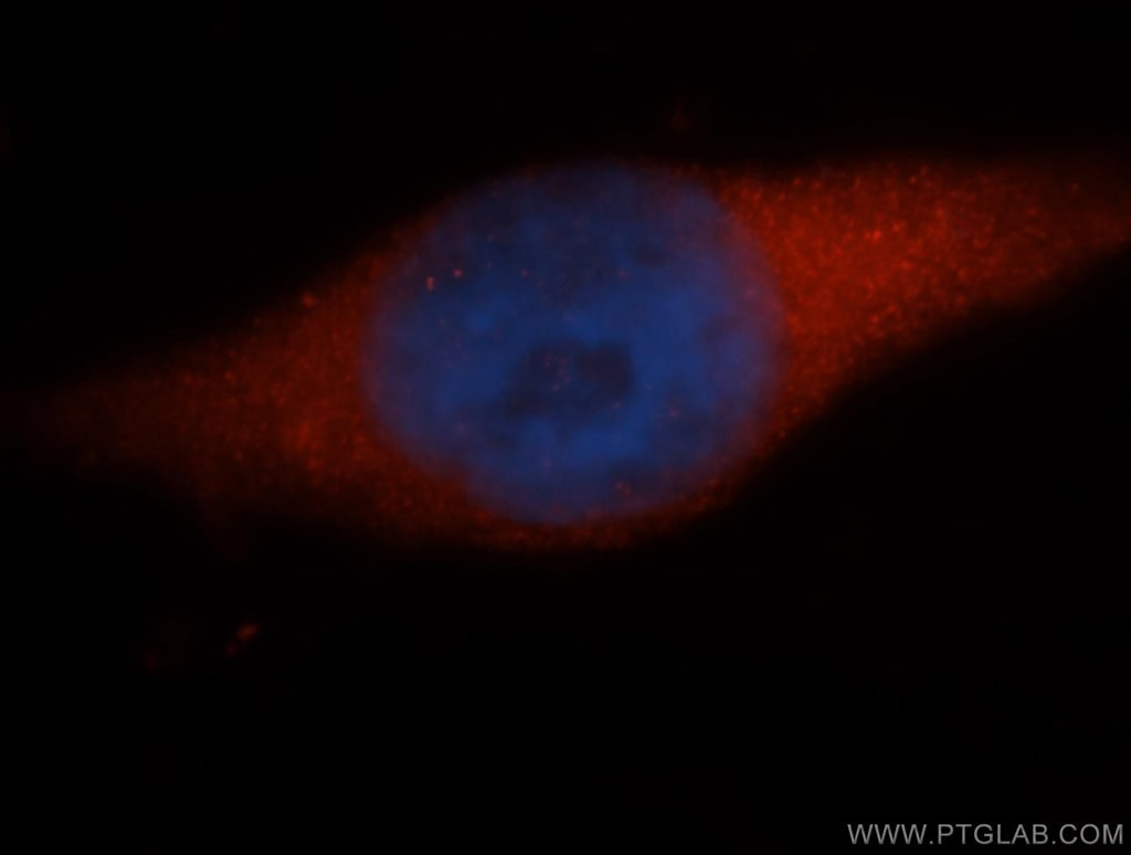 Immunofluorescence (IF) / fluorescent staining of MCF-7 cells using NAP1L1 Polyclonal antibody (14898-1-AP)