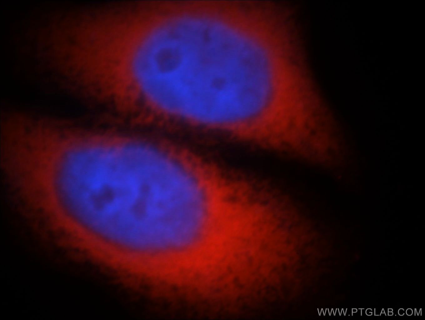 IF Staining of HeLa using 14898-1-AP