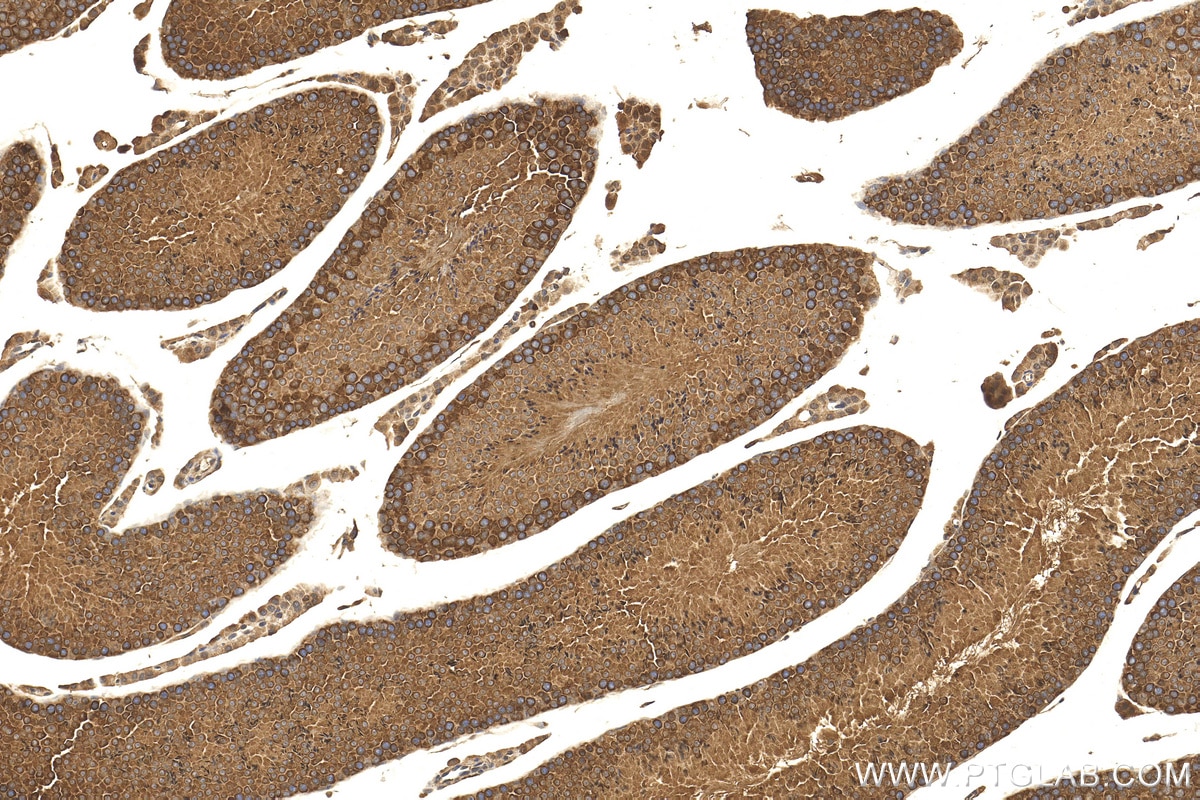 Immunohistochemistry (IHC) staining of mouse testis tissue using NAP1L1 Polyclonal antibody (14898-1-AP)