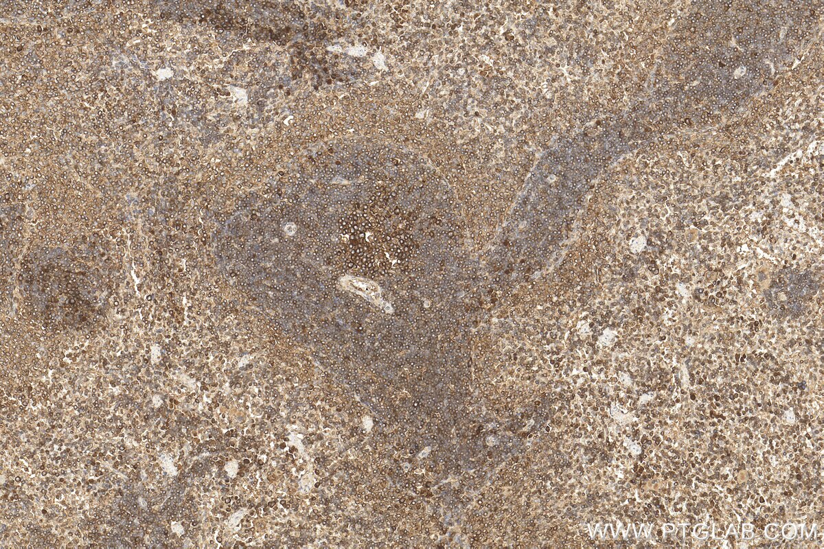 Immunohistochemistry (IHC) staining of rat spleen tissue using NAP1L1 Polyclonal antibody (14898-1-AP)
