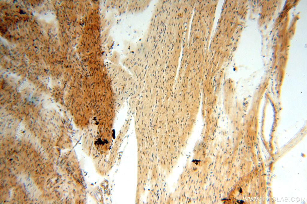 Immunohistochemistry (IHC) staining of human heart tissue using NAP1L1 Polyclonal antibody (14898-1-AP)