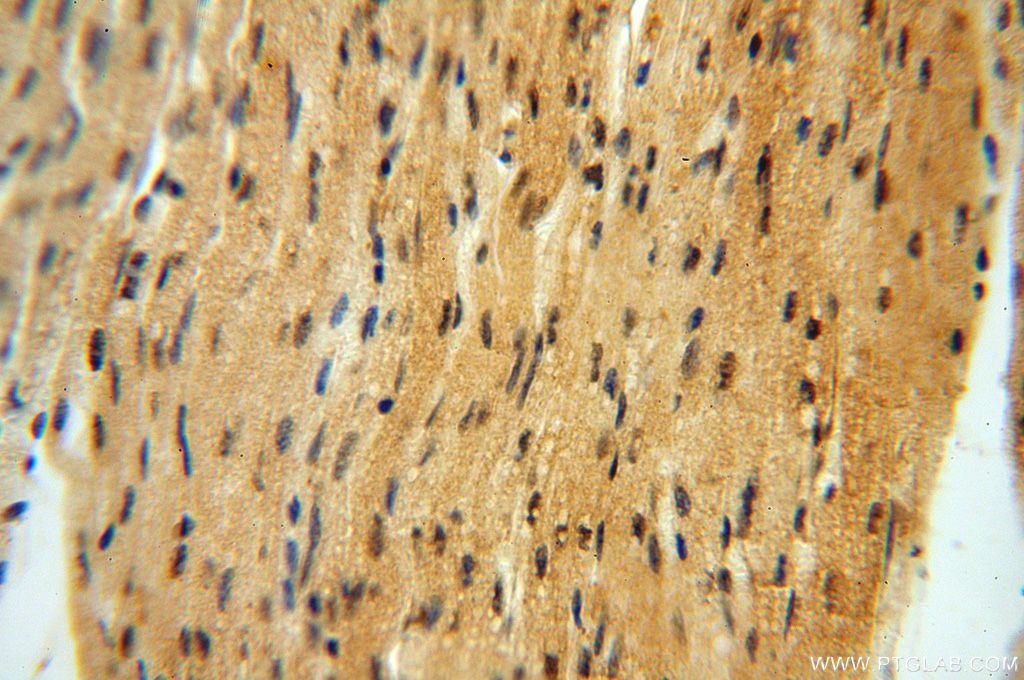 IHC staining of human heart using 14898-1-AP