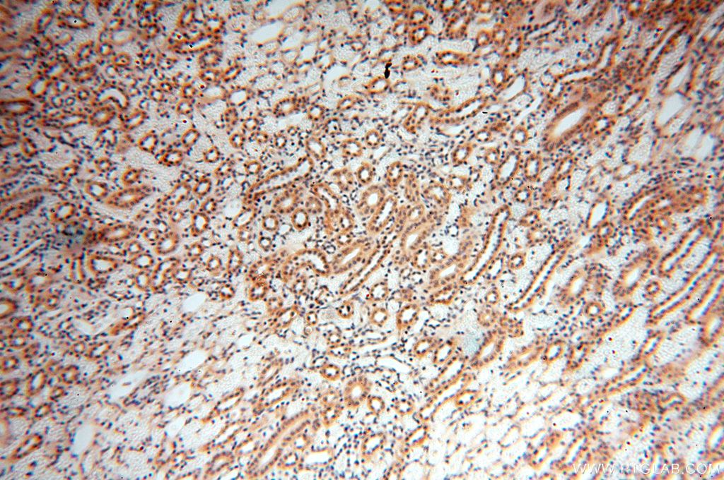 IHC staining of human kidney using 14898-1-AP