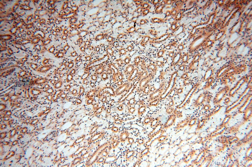 Immunohistochemistry (IHC) staining of human kidney tissue using NAP1L1 Polyclonal antibody (14898-1-AP)