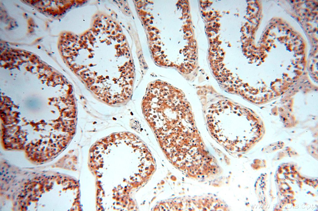 Immunohistochemistry (IHC) staining of human testis tissue using NAP1L1 Polyclonal antibody (14898-1-AP)