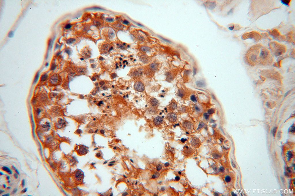 Immunohistochemistry (IHC) staining of human testis tissue using NAP1L1 Polyclonal antibody (14898-1-AP)