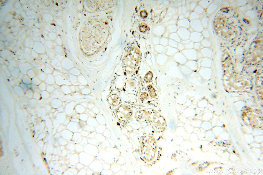 IHC staining of human skin using 14898-1-AP