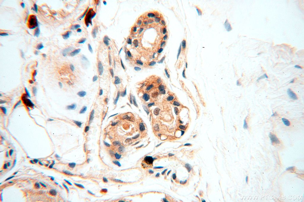 Immunohistochemistry (IHC) staining of human skin tissue using NAP1L1 Polyclonal antibody (14898-1-AP)