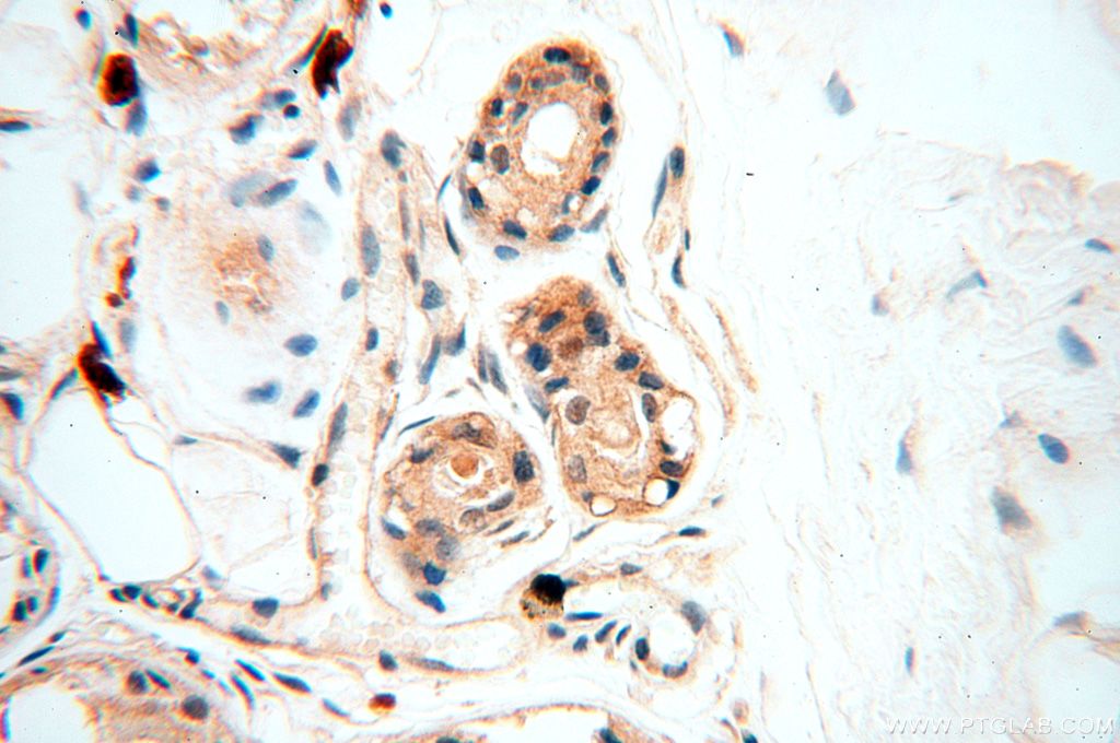 IHC staining of human skin using 14898-1-AP