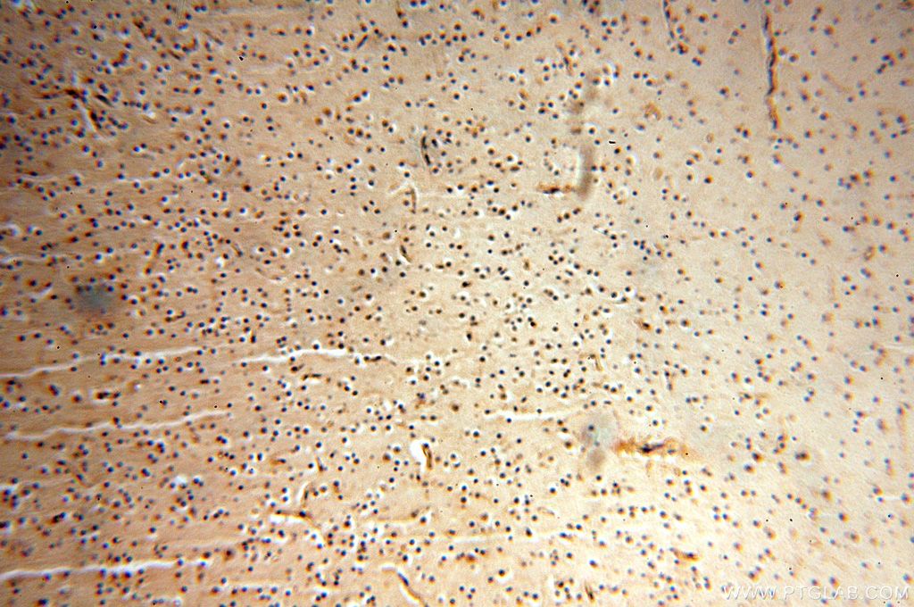 Immunohistochemistry (IHC) staining of human brain tissue using NAP1L1 Polyclonal antibody (14898-1-AP)