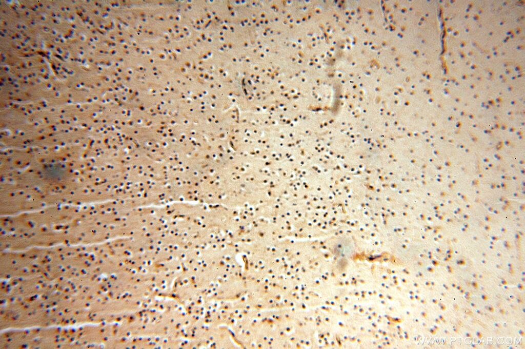 IHC staining of human brain using 14898-1-AP