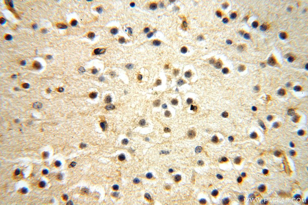 Immunohistochemistry (IHC) staining of human brain tissue using NAP1L1 Polyclonal antibody (14898-1-AP)
