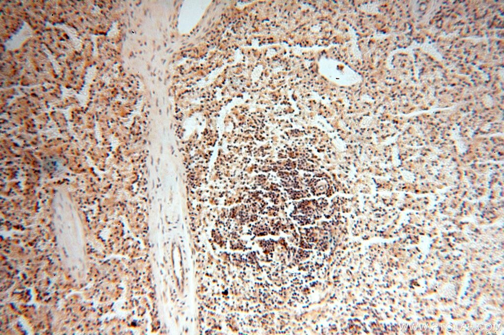 IHC staining of human spleen using 14898-1-AP