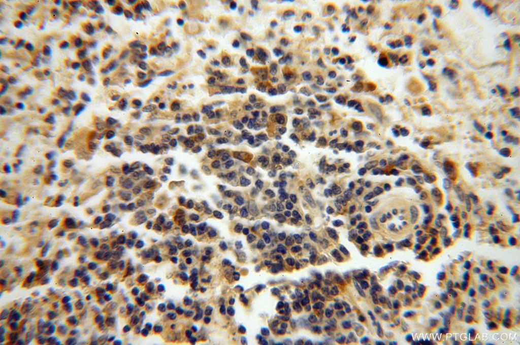 Immunohistochemistry (IHC) staining of human spleen tissue using NAP1L1 Polyclonal antibody (14898-1-AP)