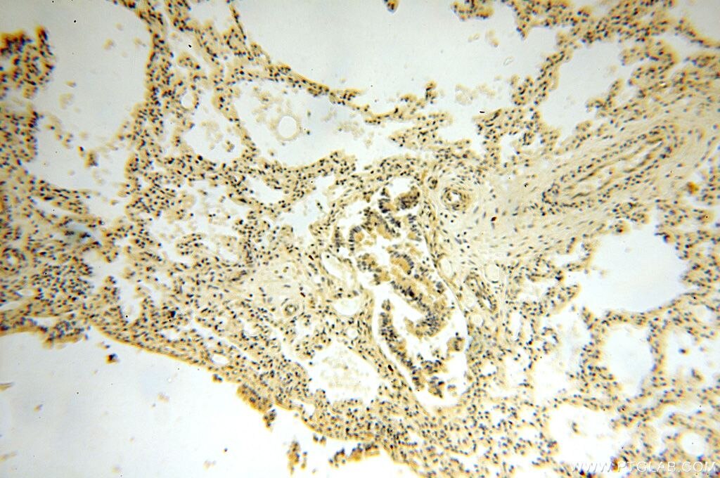 Immunohistochemistry (IHC) staining of human lung tissue using NAP1L1 Polyclonal antibody (14898-1-AP)