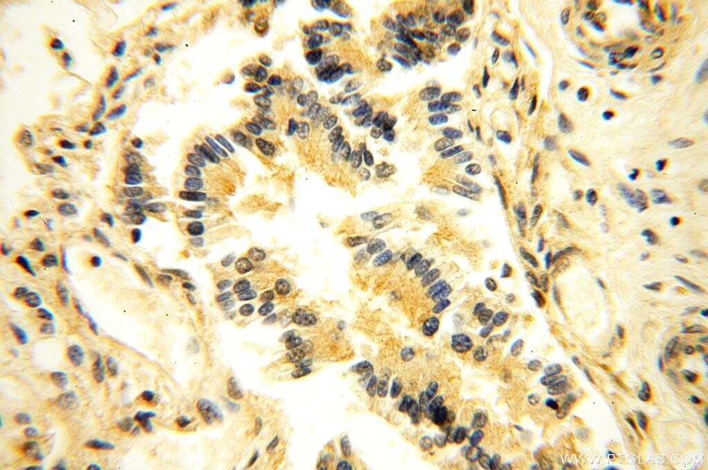 Immunohistochemistry (IHC) staining of human lung tissue using NAP1L1 Polyclonal antibody (14898-1-AP)