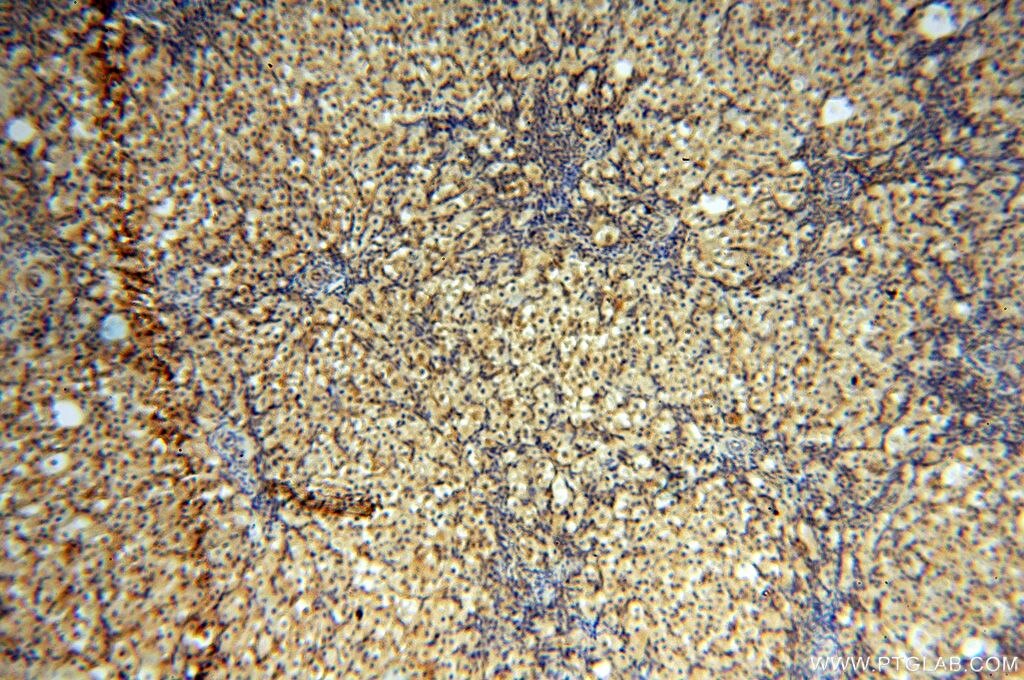 IHC staining of human ovary using 14898-1-AP