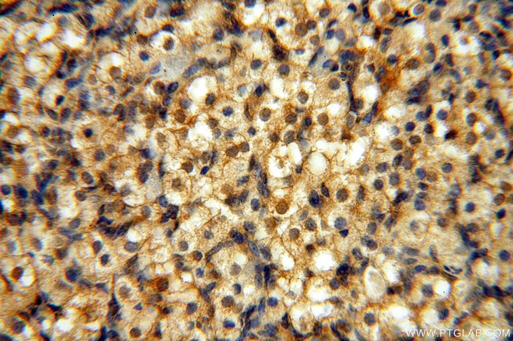 Immunohistochemistry (IHC) staining of human ovary tissue using NAP1L1 Polyclonal antibody (14898-1-AP)