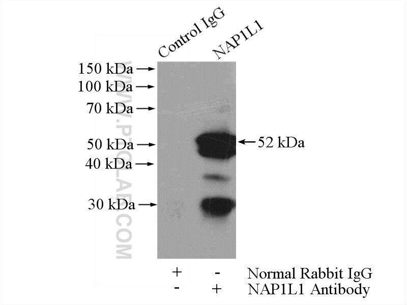 Immunoprecipitation (IP) experiment of HEK-293 cells using NAP1L1 Polyclonal antibody (14898-1-AP)
