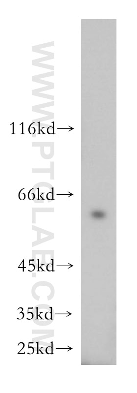 Western Blot (WB) analysis of Jurkat cells using NAP1L1 Polyclonal antibody (14898-1-AP)