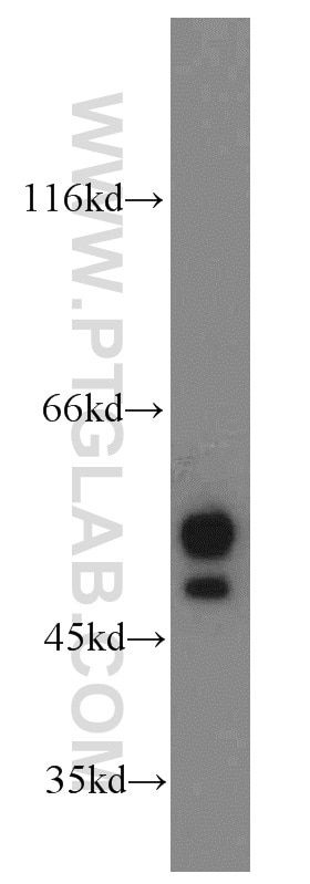 Western Blot (WB) analysis of HeLa cells using NAP1L1 Polyclonal antibody (14898-1-AP)