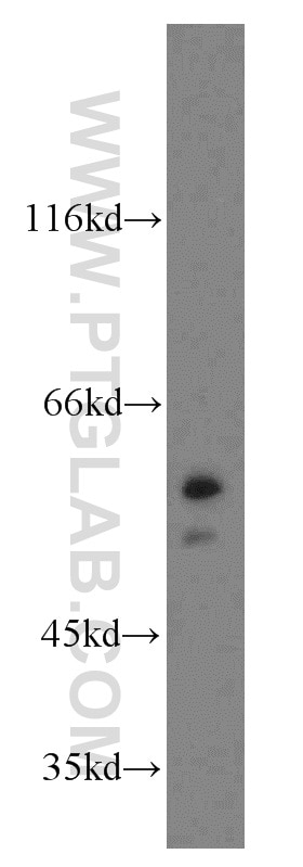 Western Blot (WB) analysis of HT-1080 cells using NAP1L1 Polyclonal antibody (14898-1-AP)
