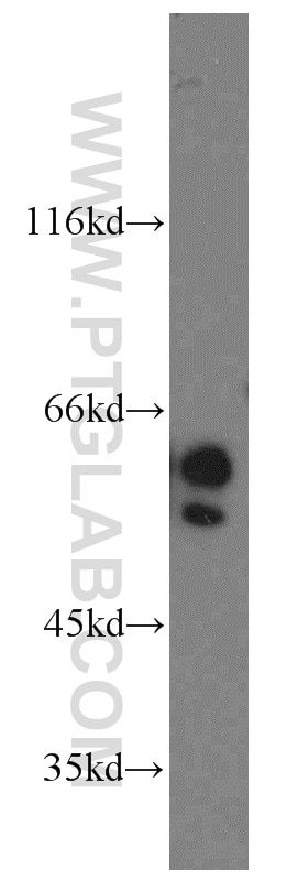 Western Blot (WB) analysis of Jurkat cells using NAP1L1 Polyclonal antibody (14898-1-AP)