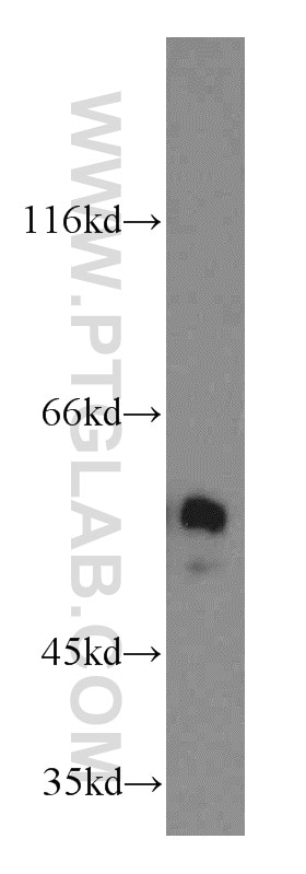 Western Blot (WB) analysis of A431 cells using NAP1L1 Polyclonal antibody (14898-1-AP)