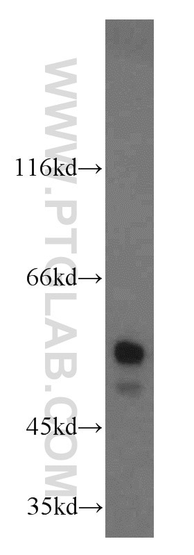 Western Blot (WB) analysis of HEK-293 cells using NAP1L1 Polyclonal antibody (14898-1-AP)