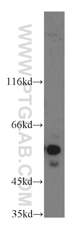 Western Blot (WB) analysis of mouse thymus tissue using NAP1L1 Polyclonal antibody (14898-1-AP)