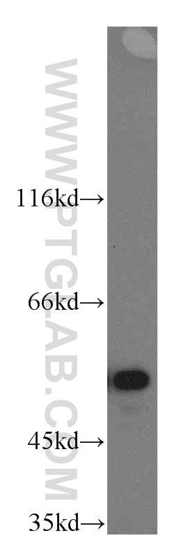 Western Blot (WB) analysis of HL-60 cells using NAP1L1 Polyclonal antibody (14898-1-AP)