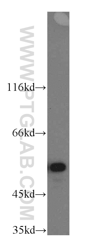 WB analysis of HL-60 using 14898-1-AP