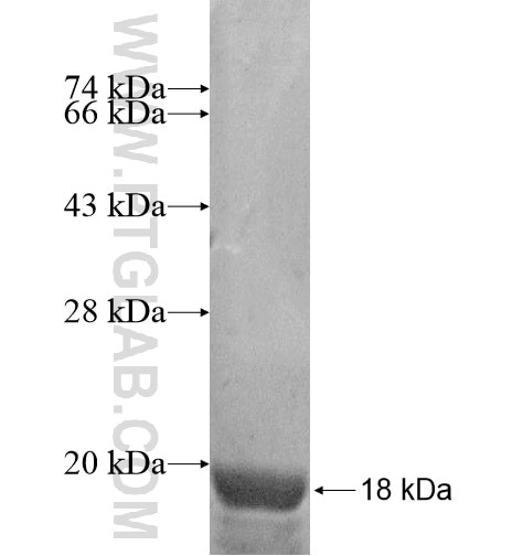 NAP1L2 fusion protein Ag14278 SDS-PAGE