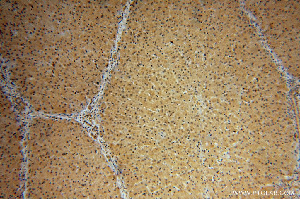 Immunohistochemistry (IHC) staining of human liver tissue using NAP1L4 Polyclonal antibody (16018-1-AP)