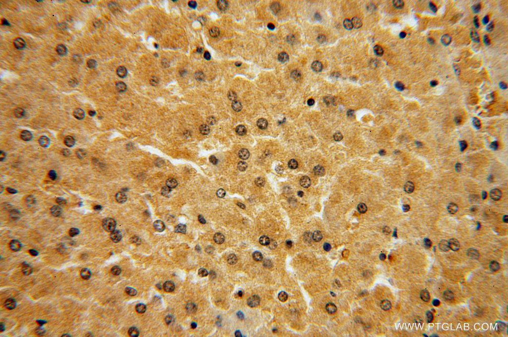 Immunohistochemistry (IHC) staining of human liver tissue using NAP1L4 Polyclonal antibody (16018-1-AP)