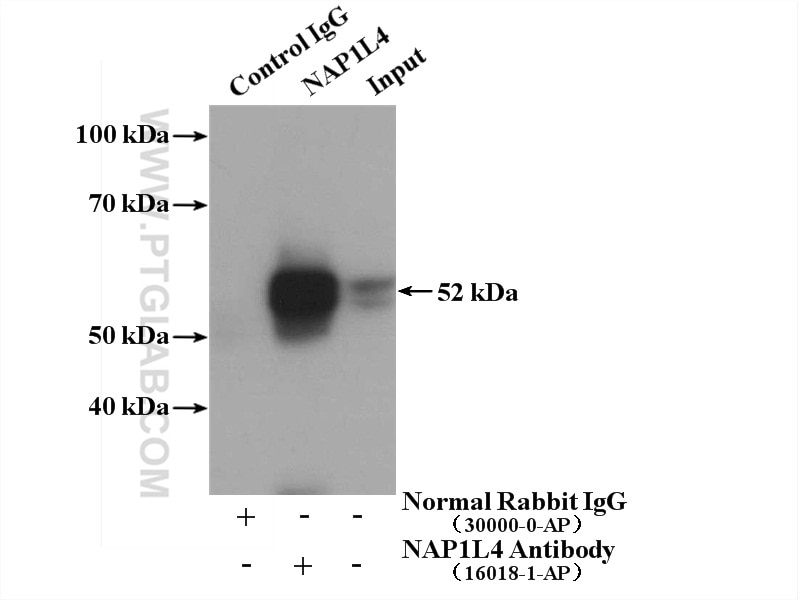 Immunoprecipitation (IP) experiment of HeLa cells using NAP1L4 Polyclonal antibody (16018-1-AP)